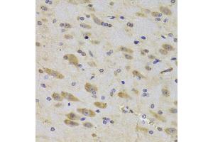 Immunohistochemistry of paraffin-embedded rat brain using RPS27 Antibody (ABIN5974067) at dilution of 1/100 (40x lens). (RPS27 anticorps)