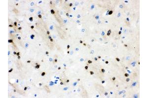 nti- Stathmin 1 Picoband antibody, IHC(P) IHC(P): Rat Brain Tissue (Stathmin 1 anticorps  (N-Term))