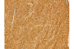 Myoferlin Antibody at 1/100 staining Mouse heart tissue by IHC-P. (Myoferlin anticorps  (Internal Region))