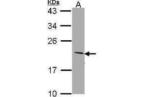 WB Image Sample (30 ug of whole cell lysate) A: Molt-4 , 12% SDS PAGE SERTAD1 antibody antibody diluted at 1:1000 (SERTAD1 anticorps  (N-Term))