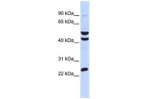 Western Blot showing ZNF200 antibody used at a concentration of 1-2 ug/ml to detect its target protein. (ZNF200 anticorps  (Middle Region))