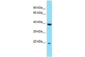 Host: Rabbit Target Name: C7orf50 Sample Type: RPMI-8226 Whole Cell lysates Antibody Dilution: 1. (C7orf50 anticorps  (N-Term))