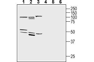 1-3. (Adiponectin Receptor 1 anticorps  (Intracellular, N-Term))