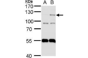 WB Image HIF2 alpha antibody detects HIF2 alpha protein by western blot analysis.