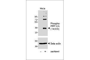 Western blot analysis of lysates from Hela cell line, untreated or treated with paclitaxel, 100nM, 20hrs, using Phospho-P1CA (Thr320) Antibody (uer) or Beta-actin (lower). (PPP1CA anticorps  (pThr320))