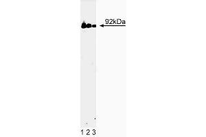 Western blot analysis of Stat3 on a A431 cell lysate (Human epithelial carcinoma, ATCC CRL-1555). (STAT3 anticorps  (AA 1-175))
