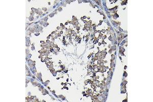 Immunohistochemistry of paraffin-embedded mouse liver using Ferritin Heavy Chain Rabbit pAb (ABIN3021538, ABIN3021539, ABIN3021540 and ABIN6215218) at dilution of 1:100 (40x lens). (FTH1 anticorps  (AA 1-183))