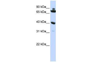 WB Suggested Anti-C7orf31 Antibody Titration: 0. (C7orf31 anticorps  (N-Term))