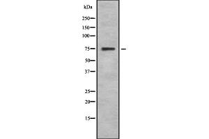 Western blot analysis SphK2 using 293 whole cell lysates (SPHK2 anticorps  (N-Term))