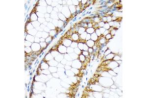Immunohistochemistry of paraffin-embedded human colon using ENTPD5 Rabbit mAb (ABIN7266895) at dilution of 1:100 (40x lens).