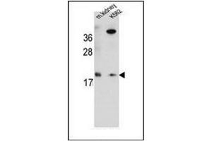 Western blot analysis of RNF185 Antibody  in Mouse kidney tissue and K562 cell line lysates (35ug/lane). (RNF185 anticorps  (Middle Region))