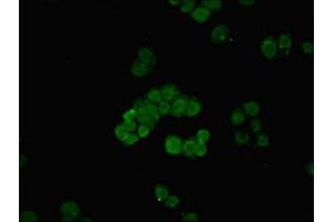 Immunofluorescent analysis of PC-3 cells using ABIN7159152 at dilution of 1:100 and Alexa Fluor 488-congugated AffiniPure Goat Anti-Rabbit IgG(H+L) (MED27 anticorps  (AA 67-165))