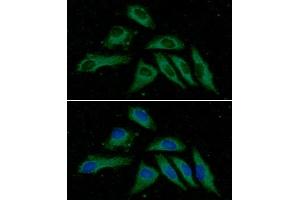 ICC/IF analysis of PPM1F in HeLa cells line, stained with DAPI (Blue) for nucleus staining and monoclonal anti-human PPM1F antibody (1:100) with goat anti-mouse IgG-Alexa fluor 488 conjugate (Green).