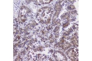IHC analysis of CFP using anti-CFP antibody (ABIN6719298).