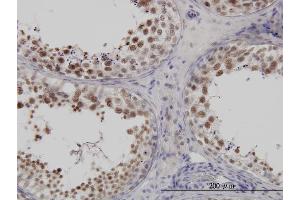 Immunoperoxidase of monoclonal antibody to FUSIP1 on formalin-fixed paraffin-embedded human testis.