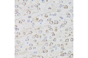 Immunohistochemistry of paraffin-embedded mouse brain using MIP antibody at dilution of 1:100 (x40 lens). (MIP anticorps)