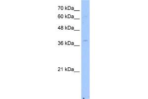 WB Suggested Anti-NSDHL Antibody Titration:  2. (NSDHL anticorps  (Middle Region))