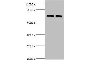 Western blot All lanes: DHX58 antibody at 12 μg/mL Lane 1: 293T whole cell lysate Lane 2: Rat kidney tissue Secondary Goat polyclonal to rabbit IgG at 1/10000 dilution Predicted band size: 77 kDa Observed band size: 77 kDa (DHX58 anticorps  (AA 389-678))
