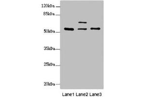 Western blot All lanes: ERO1L antibody at 2. (ERO1L anticorps  (AA 24-260))