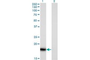 Western Blot analysis of PLA2G16 expression in transfected 293T cell line by PLA2G16 monoclonal antibody (M02), clone 4C4-2A11.