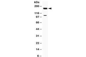 Western blot testing of human MCF7 cell lysate with TIAM1 antibody at 0. (TIAM1 anticorps  (AA 1518-1554))
