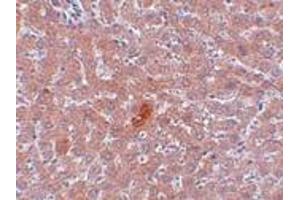 Immunohistochemistry (IHC) image for anti-Lysine (K)-Specific Demethylase 3A (KDM3A) (N-Term) antibody (ABIN1031423)