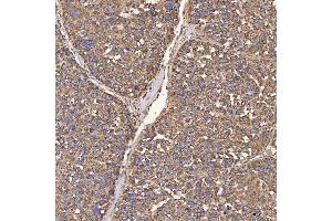 IHC analysis of HSD11B2 using anti-HSD11B2 antibody (ABIN7602698).