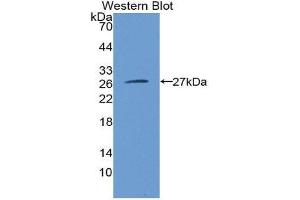 Western Blotting (WB) image for anti-C-Reactive Protein (CRP) (AA 17-224) antibody (ABIN1077875) (CRP anticorps  (AA 17-224))