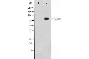Western blot analysis on LOVO cell lysate using Cullin 2 Antibody,The lane on the left is treated with the antigen-specific peptide.