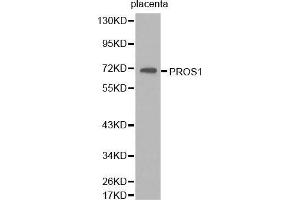 Western Blotting (WB) image for anti-Protein S (PROS) (AA 405-676) antibody (ABIN6218667) (PROS1 anticorps  (AA 405-676))