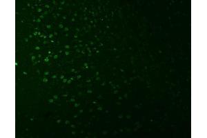 IF analysis of SNRNP27 using anti-SNRNP27 antibody (ABIN7599614). (SNRNP27 anticorps  (AA 100-155))