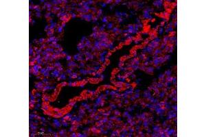 Immunofluorescence of paraffin embedded rat lung using LRP (ABIN7074548) at dilution of 1: 200 (250x lens)