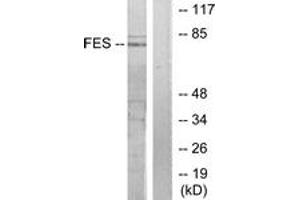 Western blot analysis of extracts from HuvEc cells, treated with serum 20% 30', using FES Antibody. (FES anticorps  (AA 131-180))