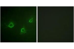 Immunofluorescence analysis of COS7 cells, using PLCG1 (Ab-1253) Antibody. (Phospholipase C gamma 1 anticorps  (AA 1221-1270))