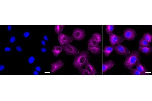 Immunocytochemical staining of HT- cells with EIF2AK4 antibody (ABIN7798505), 1:1,000).