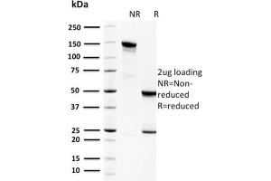 SDS-PAGE Analysis Purified Spermidine Monoclonal Antibody (CPTC-SAT1-3).