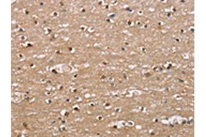 The image on the left is immunohistochemistry of paraffin-embedded Human brain tissue using ABIN7189673(ADGRB2 Antibody) at dilution 1/25, on the right is treated with synthetic peptide. (BAI2 anticorps)