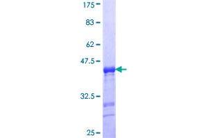 Image no. 1 for Enamelin (ENAM) (AA 1043-1141) protein (GST tag) (ABIN1352783)