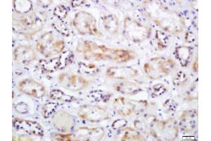 Formalin-fixed and paraffin embedded human kidney labeled with Rabbit Anti-SLC25A10 Polyclonal Antibody, Unconjugated  at 1:200 followed by conjugation to the secondary antibody and DAB staining (SLC25A10 anticorps  (AA 201-287))