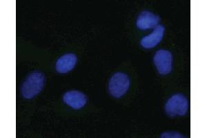 Immunofluorescent staining of HeLa cells. (MAPK14 anticorps  (pThr180))