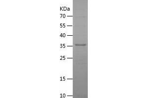 Western Blotting (WB) image for metallophosphoesterase Domain Containing 2 (MPPED2) (AA 1-294) protein (His tag) (ABIN7123923)