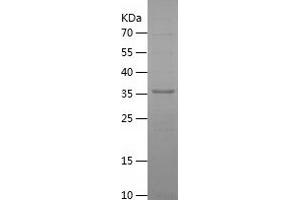 Western Blotting (WB) image for metallophosphoesterase Domain Containing 2 (MPPED2) (AA 1-294) protein (His tag) (ABIN7123923) (MPPED2 Protein (AA 1-294) (His tag))