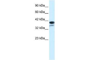 PARP6 antibody used at 1. (PARP6 anticorps)