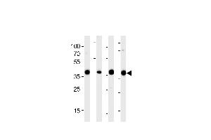 Western blot analysis of lysates from 293,RD,mouse NIH/3T3,rat L6 cell line (from left to right),using ALDOA Antibody (N-term) (ABIN389191 and ABIN2839354). (ALDOA anticorps  (N-Term))