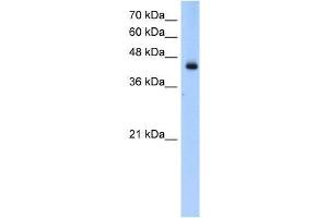 Transfected 293T; WB Suggested Anti-ACADL Antibody Titration: 0. (ACADL anticorps  (N-Term))