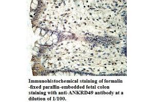 Image no. 1 for anti-Ankyrin Repeat Domain 49 (ANKRD49) antibody (ABIN1574707) (ANKRD49 anticorps)