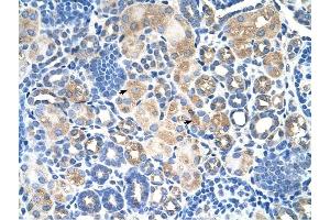 SLC38A1 antibody was used for immunohistochemistry at a concentration of 4-8 ug/ml to stain EpitheliaI cells of renal tubule (arrows) in Human Kidney. (SLC38A1 anticorps  (Middle Region))