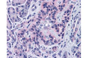 Immunohistochemistry (IHC) image for anti-Sirtuin 4 (SIRT4) (Middle Region) antibody (ABIN2779654)