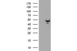 Western Blotting (WB) image for anti-Potassium Voltage-Gated Channel, Shaker-Related Subfamily, beta Member 1 (KCNAB1) antibody (ABIN1499004) (KCNAB1 anticorps)