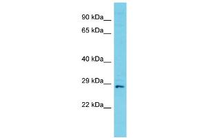 Host: Rabbit Target Name: C11orf70 Sample Type: Jurkat Whole Cell lysates Antibody Dilution: 1. (C11ORF70 anticorps  (C-Term))